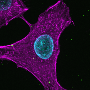 New findings help scientists understand how viruses enter host cells in unprecedented detail New findings help scientists understand how viruses enter host cells in unprecedented detail